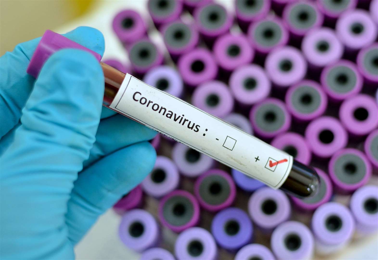  coronavirus-casos-brasil 