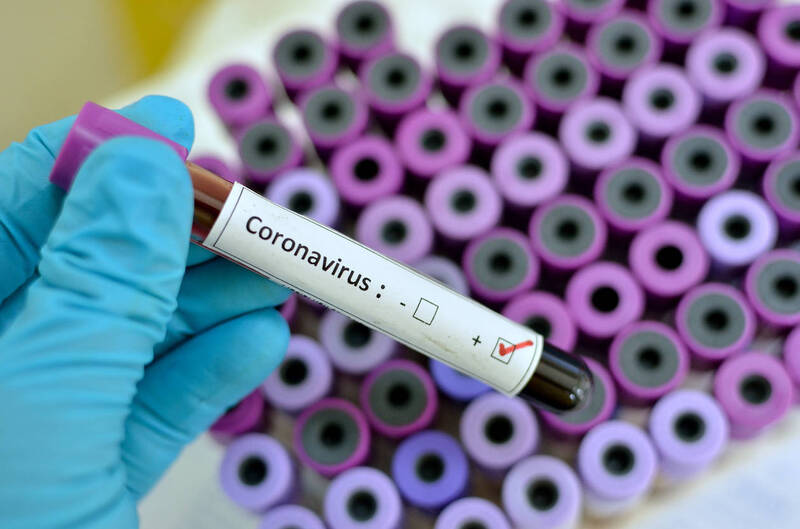  coronavirus brasil 