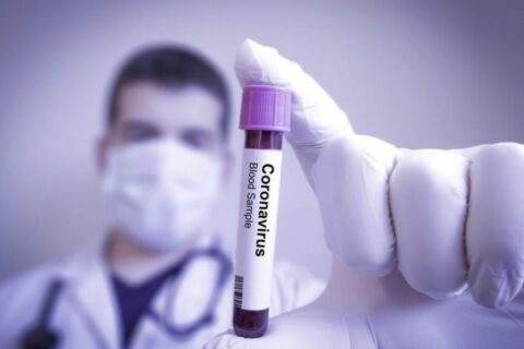  coronavirus-transparencia-parana 