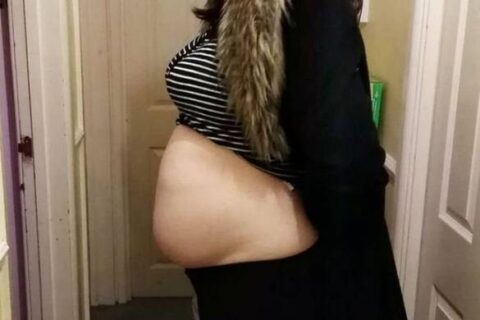  Mulher achou que estava grávida, mas era um tumor. (Foto: reprodução do Mirror.co.uk) 