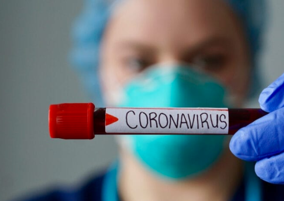  vacina-coronavirus 