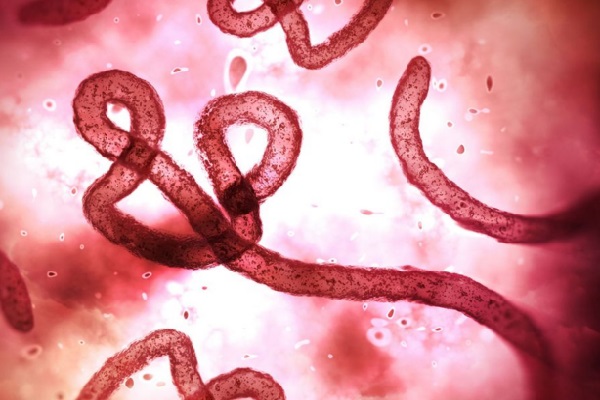 ebola-sintomas