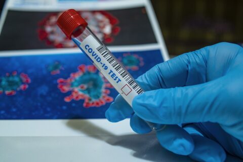  Brasil novos casos de coronavírus 
