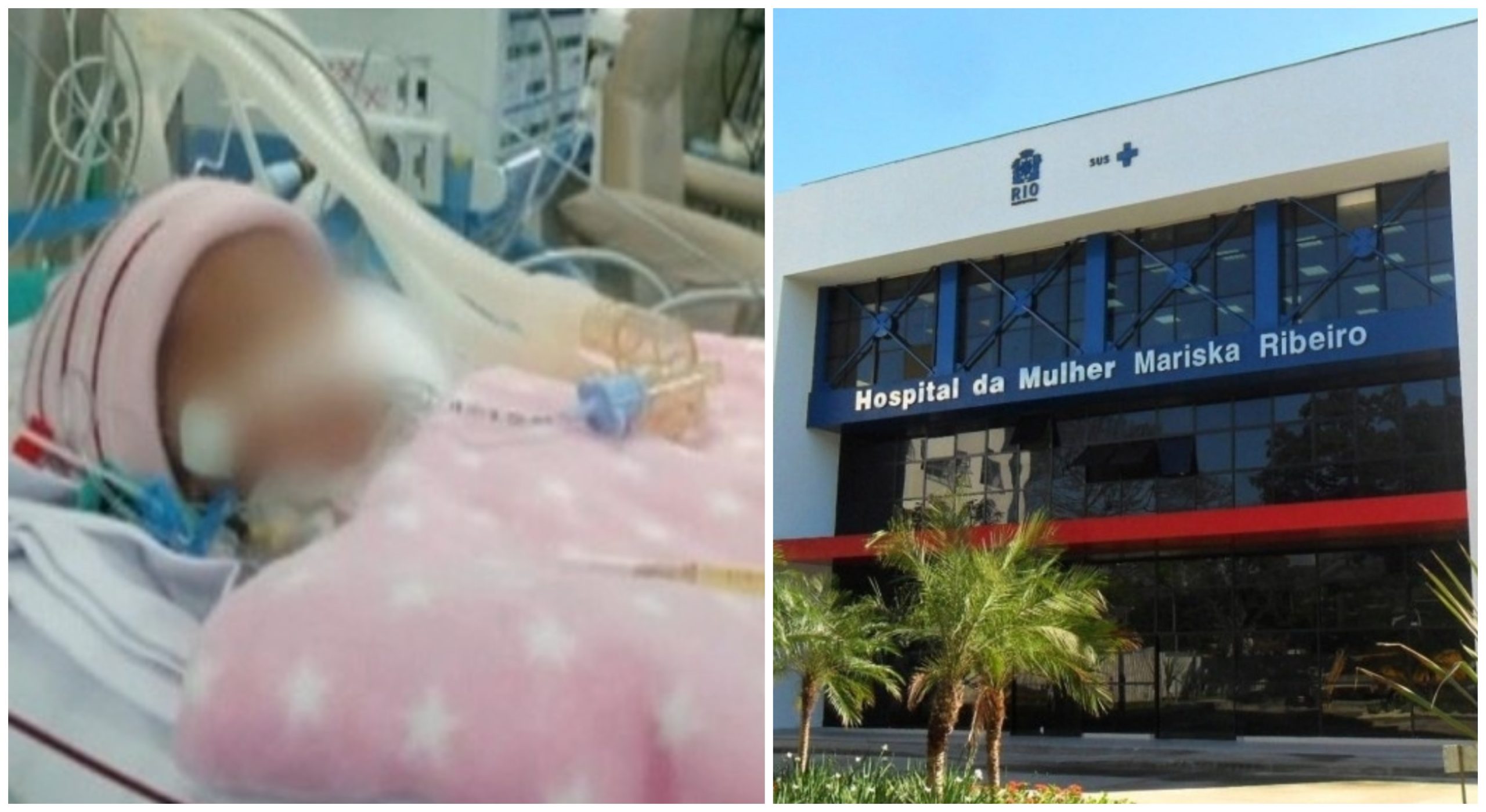  Bebê de cinco dias morre após ser ferida na cabeça durante o parto 