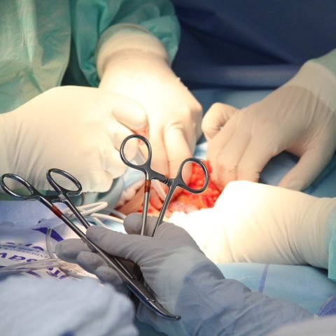 cirurgia bala clitóris
