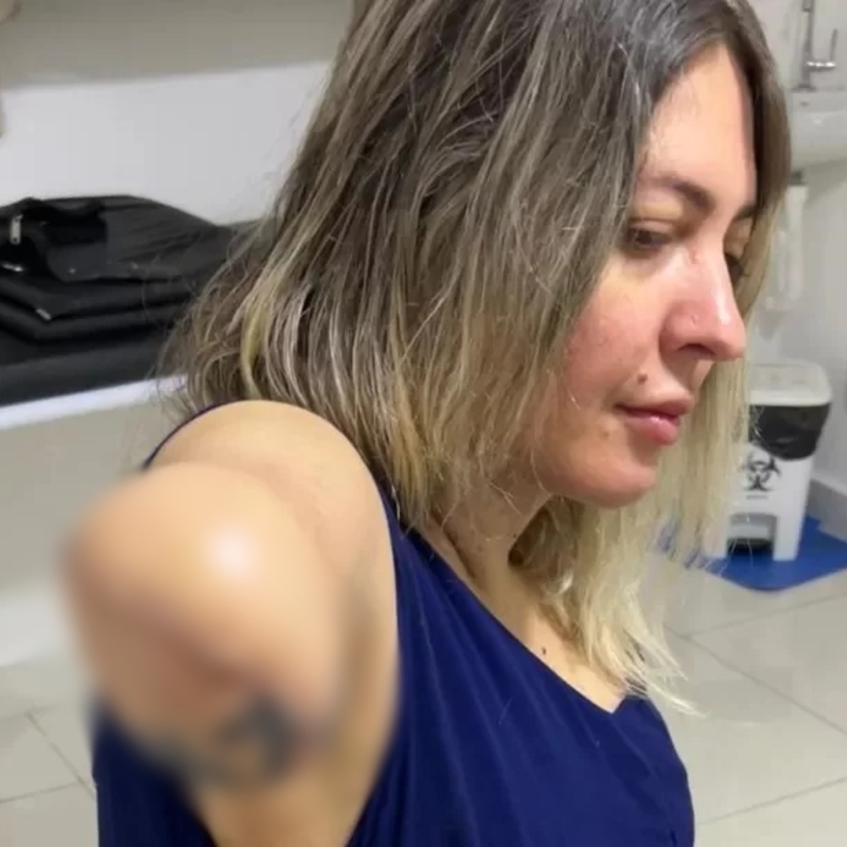  Tatuadora tem braço amputado após fazer procedimento estético 