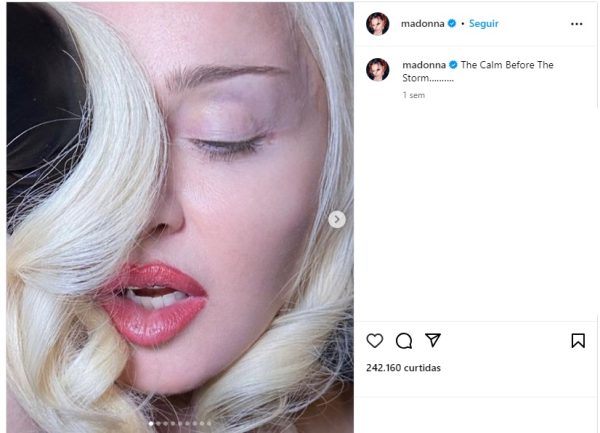 “Calmaria antes da tempestade” diz Madonna em último post antes de ser internada