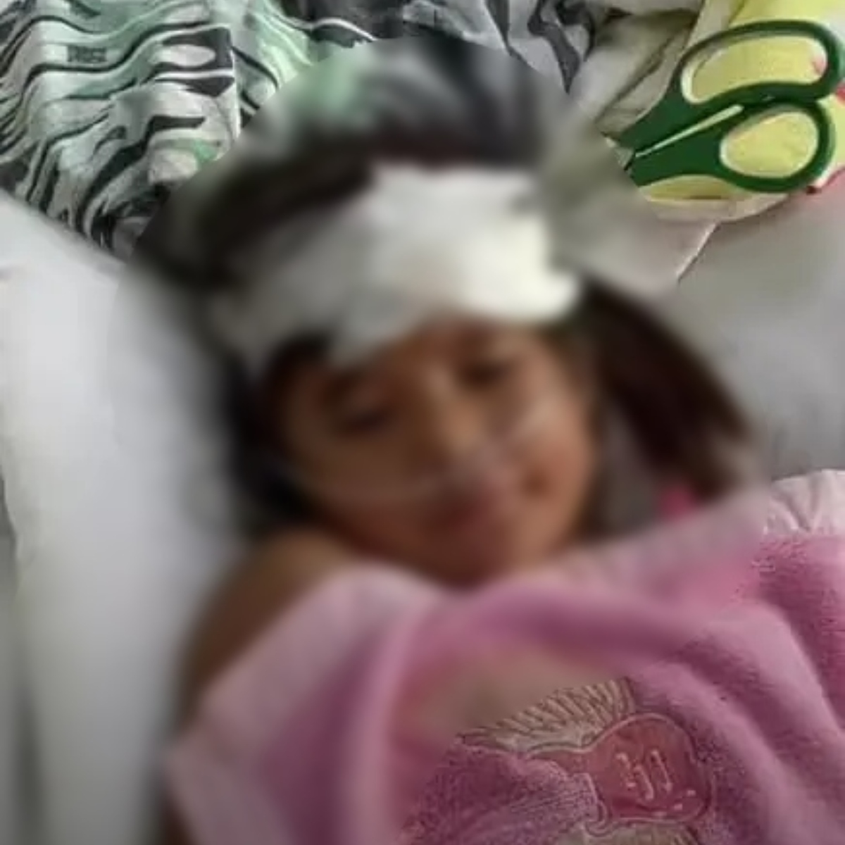  Criança finca tesoura na cabeça da irmã de 9 anos durante briga 