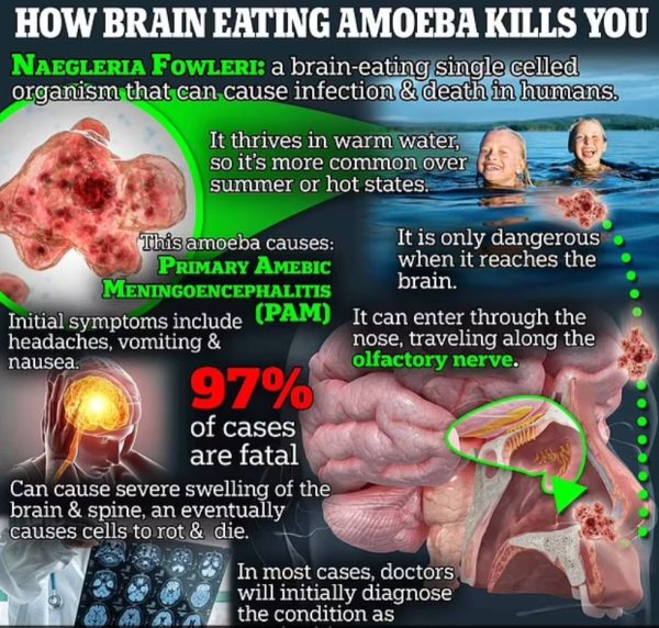 homem-morre-ameba-comedora-cerebro