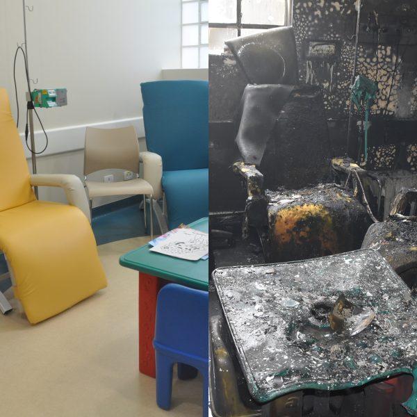 Hospital Pequeno Príncipe - antes e depois incêndio