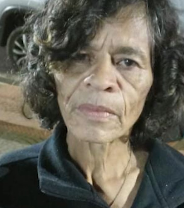  mulher morre após ser queimada 