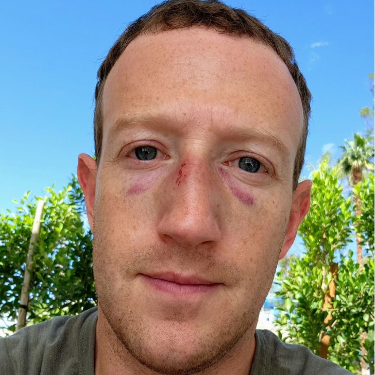  Mark Zuckerberg posta foto com o rosto machucado 