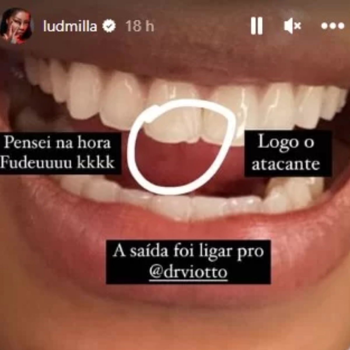  dente ludmilla 