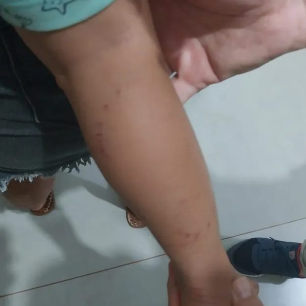 Sucuri ataca criança de 2 anos que brincava às margens de rio