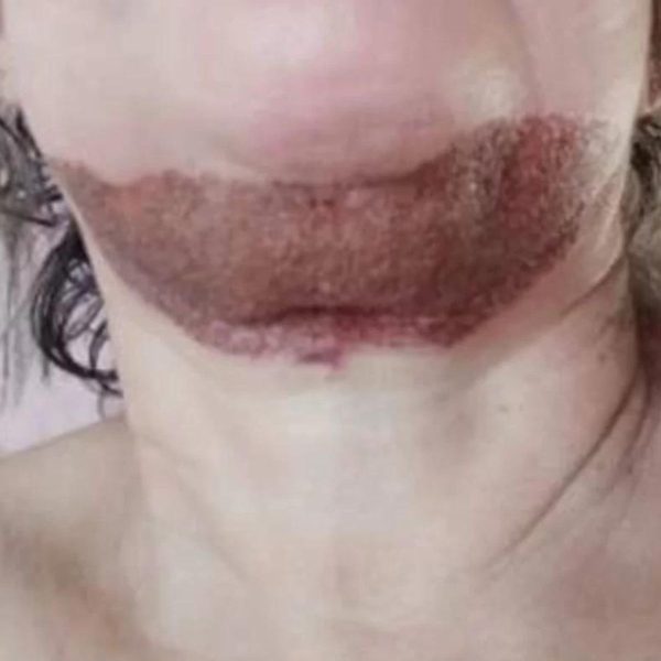 Dentista é presa por deformar rosto de pacientes em cirurgias ilegais