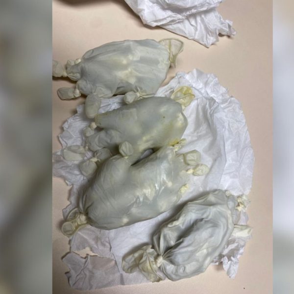 Foto de quatro luvas cirúrgicas brancas 'recheadas' com maconha