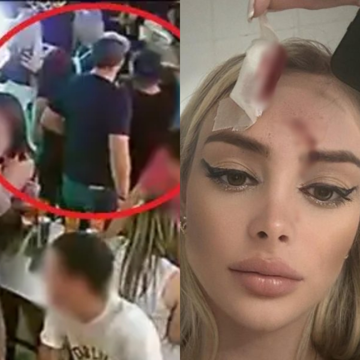  Modelo agredida com garrafada em bar de Curitiba 