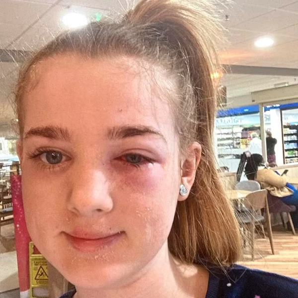  skincare tiktok cega menina de 13 anos 