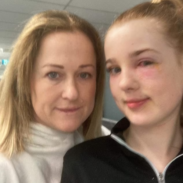 skincare tiktok cega menina de 13 anos