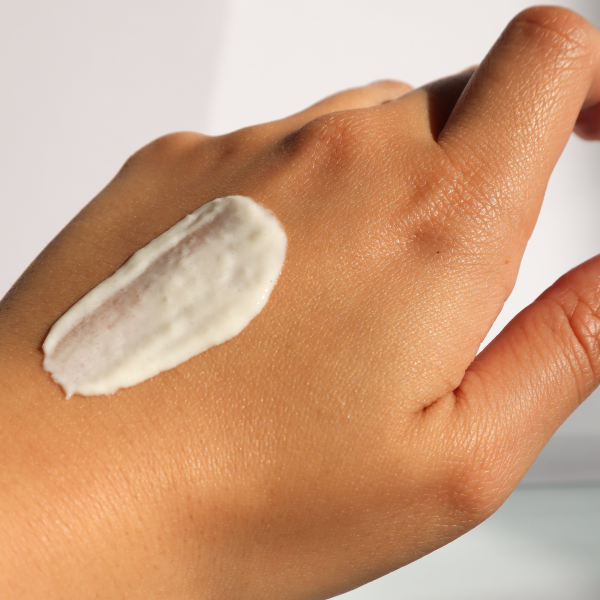 Uma das formas de evitar a coceira e dermatite é mantendo a pele bem hidratada.