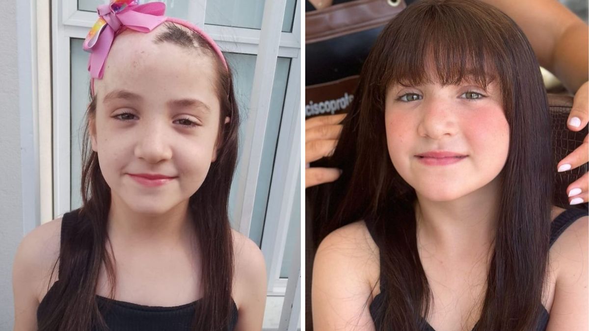 Aghata Rafaella Lechinheski, de 7 anos, viajou 12 horas de carro, com os pais, para receber uma prótese capilar e comoveu a web com o resultado.