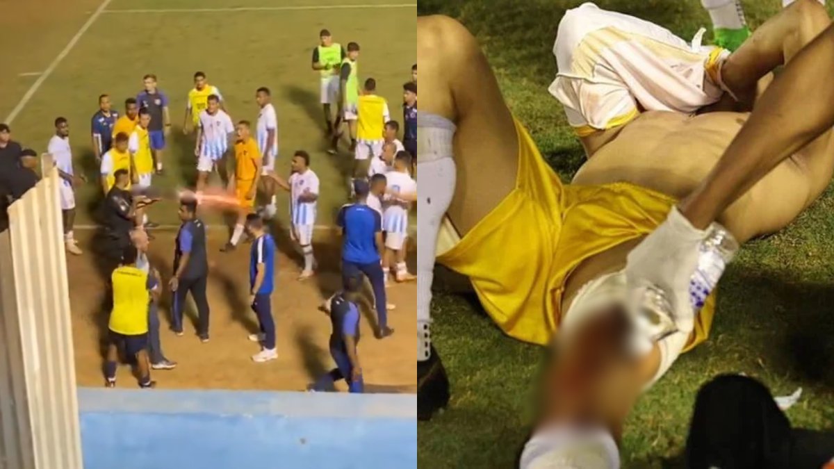 Goleiro é baleado na perna por policial durante confusão após jogo; vídeo