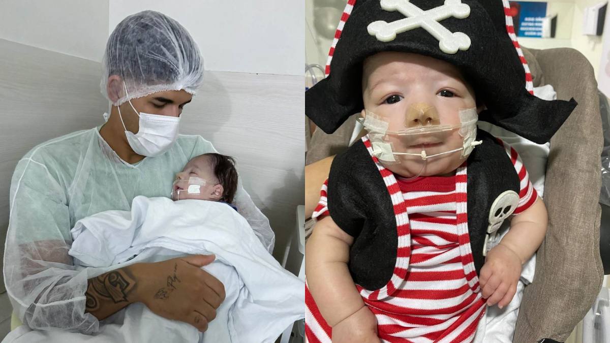 Síndrome de Patau: saiba o que é a condição do bebê Arthur, filho de Zé Vaqueiro