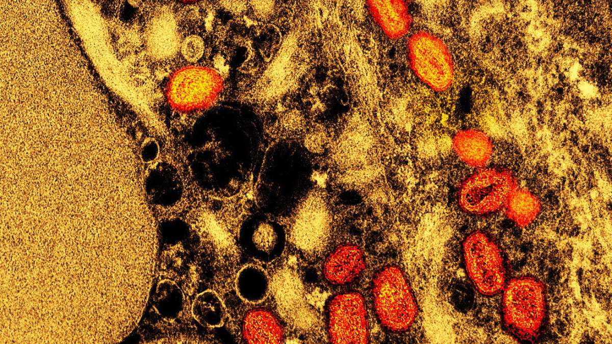 Cientistas afirmam que nova cepa de mpox está mudando muito rápido