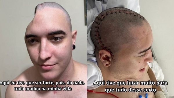 Deolane Bezerra é influencer e advogada